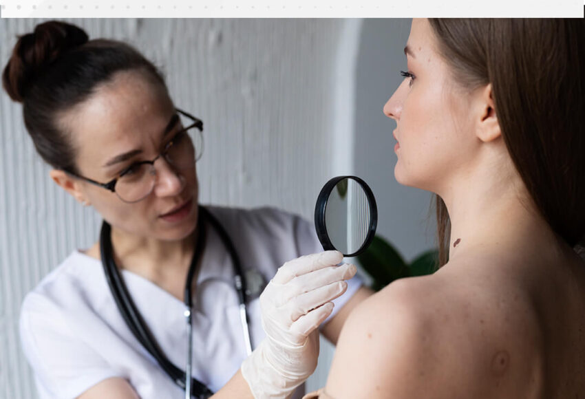 Cutaneous Melanoma Treatment