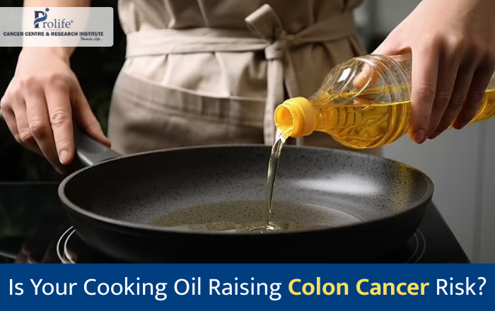 Is Your Cooking Oil Increasing Your Risk of Colon Cancer? What You Need to Know